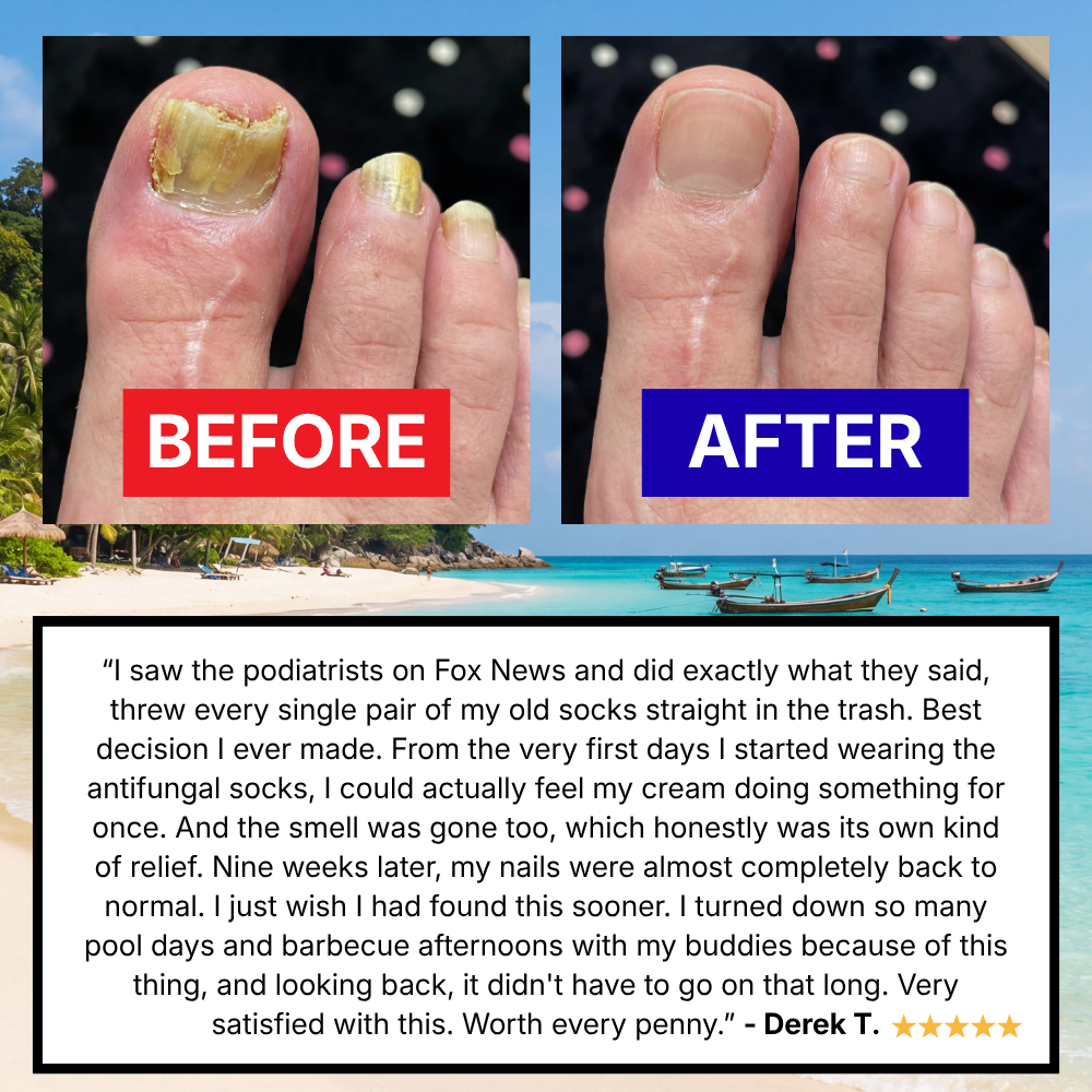 KFL Antifungal Socks